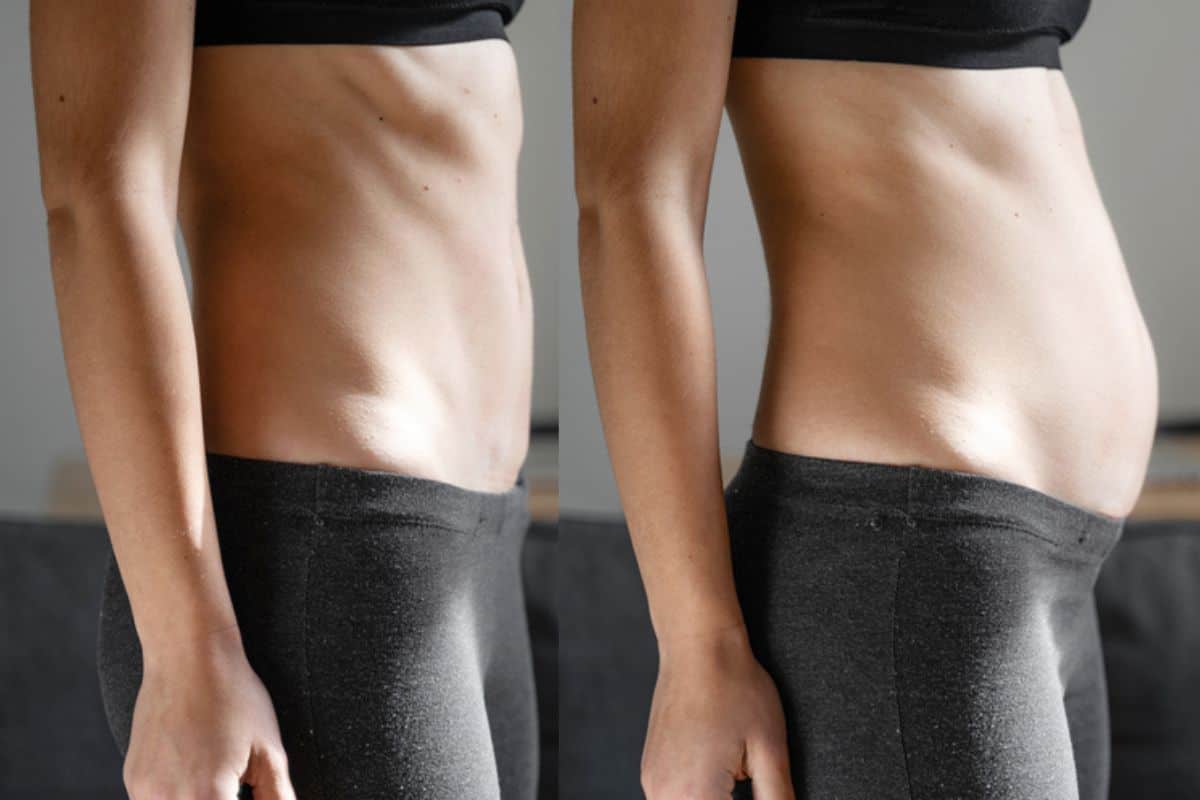 How long does diastasis recti take to improve Bethnal Green?