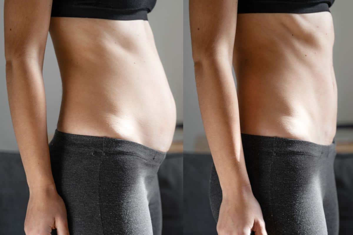 Post-Pregnancy: What Happens to Your Abdominal Muscles After Birth Bethnal Green