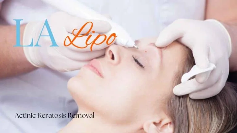 Woman receiving Actinic Keratosis Removal Treatment Bethnal Green