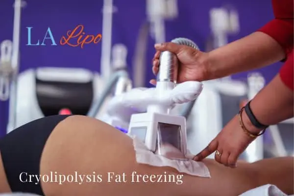 women getting fat freezing Bethnal Green