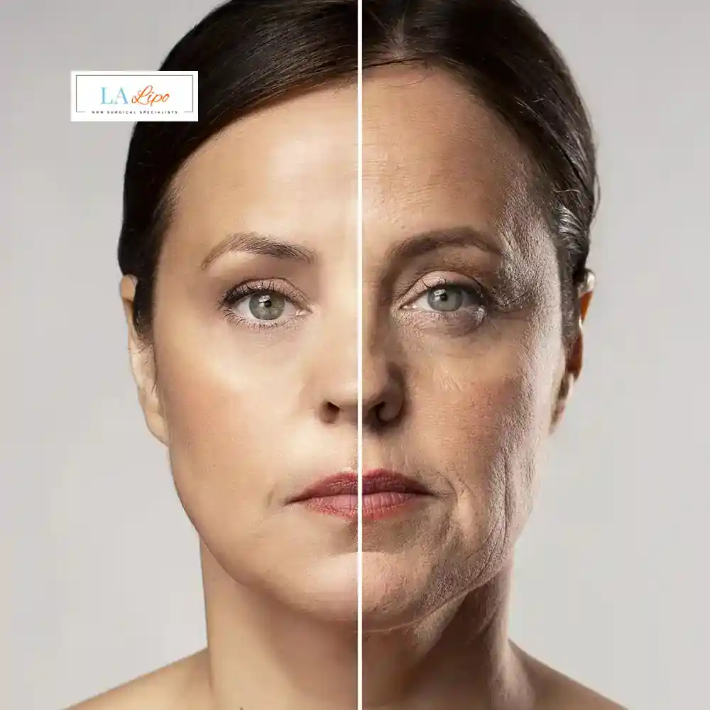 How Can You Tell If Non-Surgical Skin Tightening Is Right for You Bethnal Green?