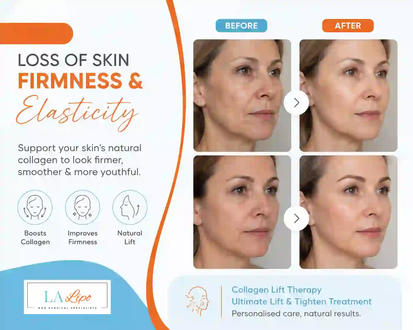 Sign #7: Loss of Skin Firmness and Elasticity Bethnal Green